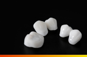 Five white dental restorations against black background