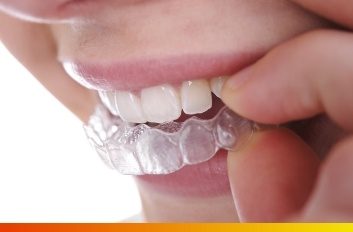 Invisible Braces in Brooklyn, NY - Best Specialist Orthodontist